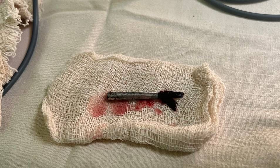 В Саратове трёхлетняя девочка едва не погибла во время рисования